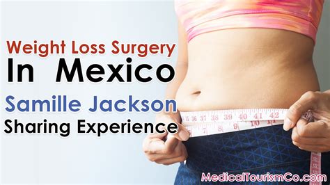 kassin weightloss surgery in mexico